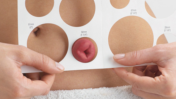 Stoma Measuring Guides